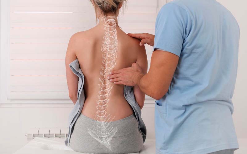 escoliosis